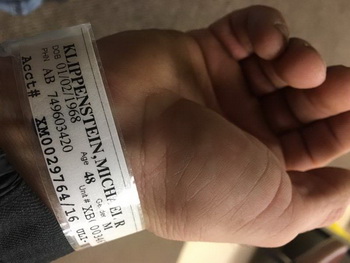 >Χάνει το KaruJet o Klippenstein