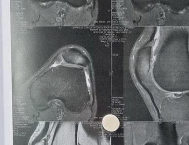 Τραυματίας ο Barret